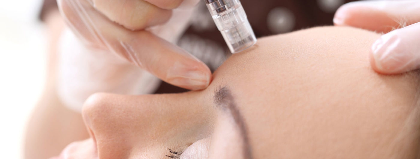 Micro Needling